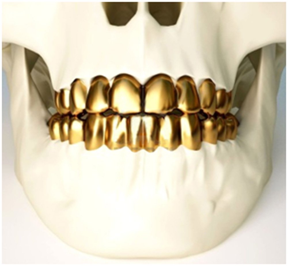 ¿Cuánto cuesta una Sonrisa de Oro?