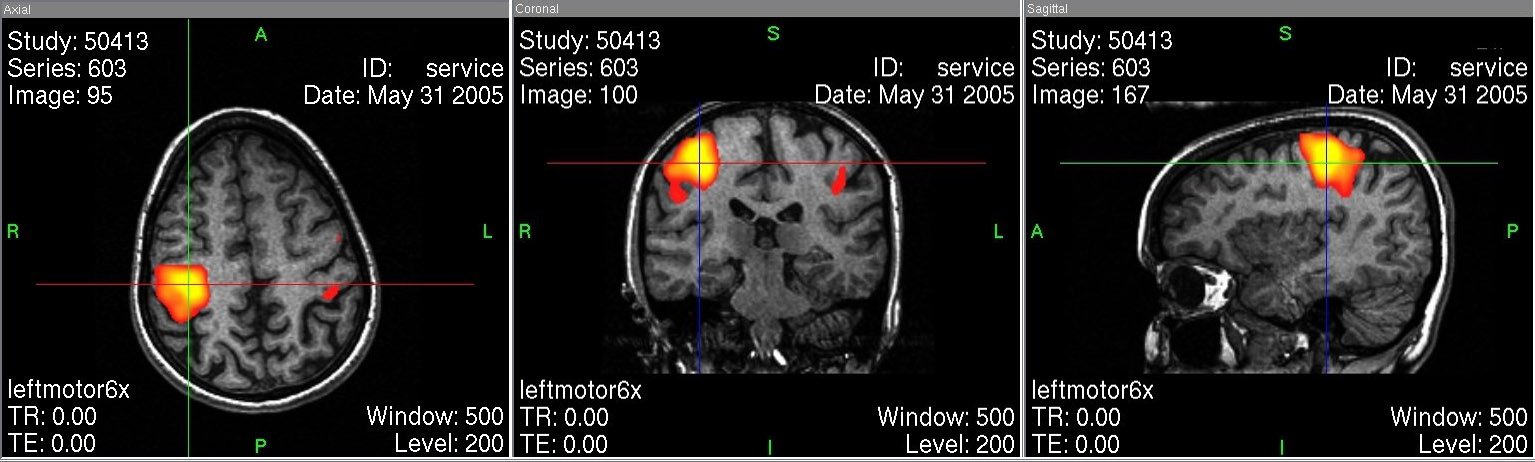 ¿Es posible Graficar la Conciencia?