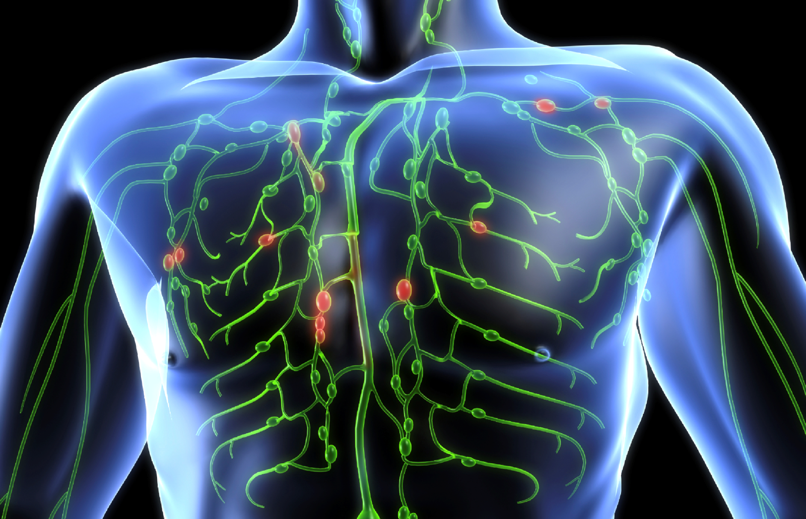 Hofgekin: Cáncer del sistema linfático