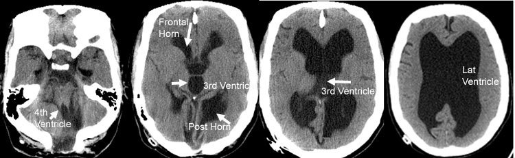 La Teoría de un Cuarto Cerebro