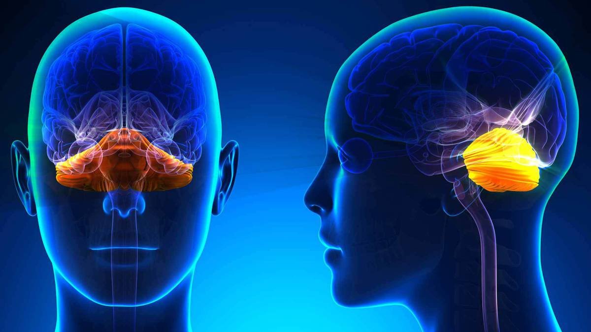 Ataxia de Friedreich