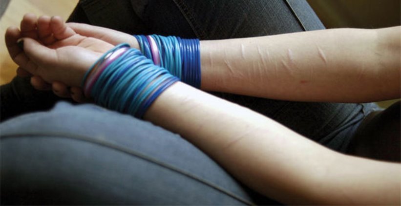 Auto lesión o Auto mutilación