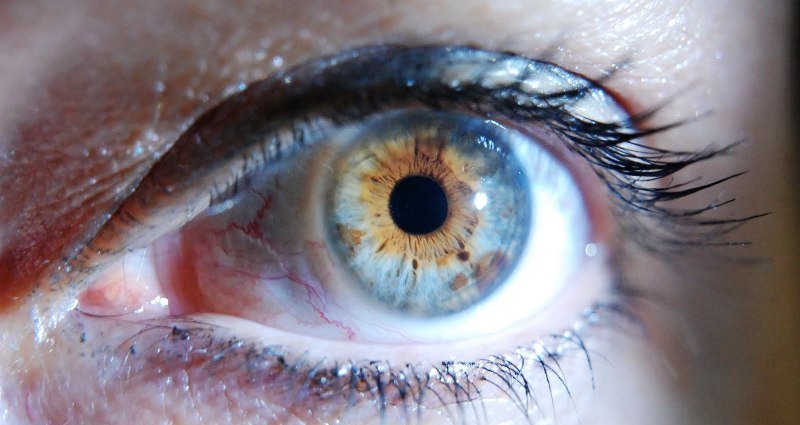 Iridología, Iridiología