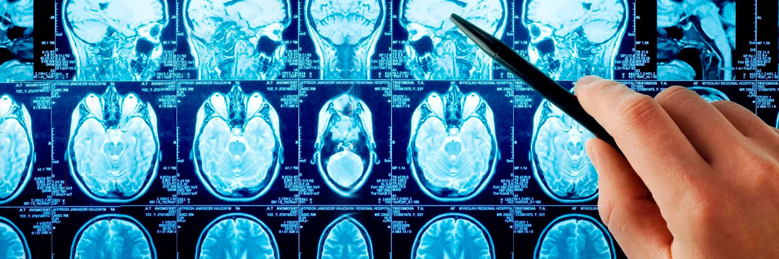 ¿Qué es la Neurociencia Cognitiva?