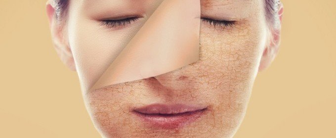 Grietas, piel seca e impétigo