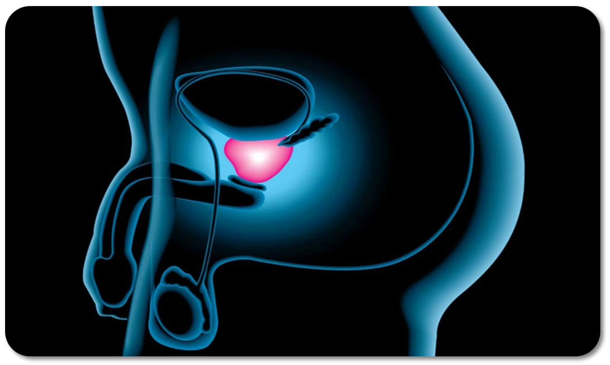 Prostata y Prostatitis