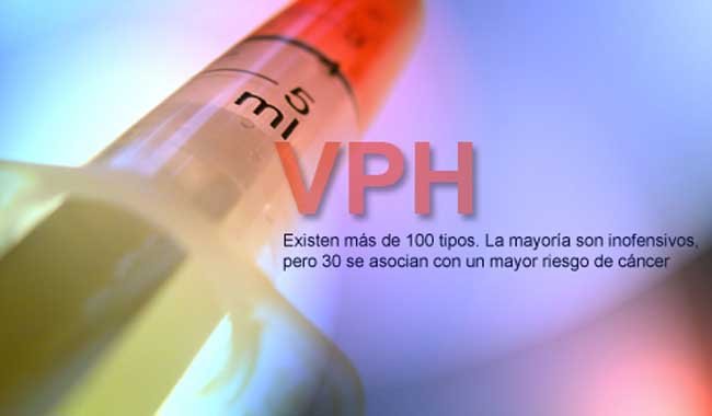 virus del papiloma humano