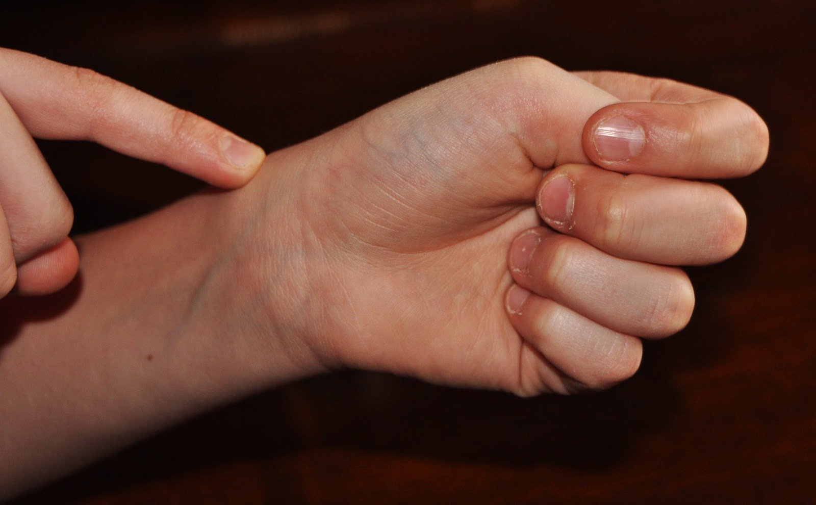 Inflamación de los Tendones